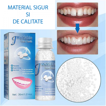 Kit de Reparare Temporara a Dintilor Profesional SUPER TRENDS®, Granule Pentru Reparatii Dentare, Bilute Reutilizabile, Non Toxic, 30 ml [7]