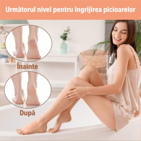 Pila Calcaie SUPER TRENDS® Profesionala Din Otel Inoxidabil Cu Maner Ergonomic Antialunecare, Pila Profesionala Cu Suprafata Dubla Pentru Indepartarea Pielii Ingrosate, Pila Calcaie Pentru Calcaie Uscate Si Aspra, Accesoriu Pedichiura Manual, 28 x 6 cm [5]