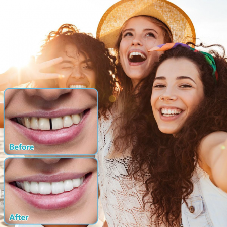 Set Proteze Dentare Premium SUPER TRENDS®, Contine Partea de Sus 1 Buc si Partea Jos 1 Buc, Fatete Dentare Cosmetice, Acopera Dintii Lipsa, Zambet Perfect, Silicon, Alb-Roz [6]