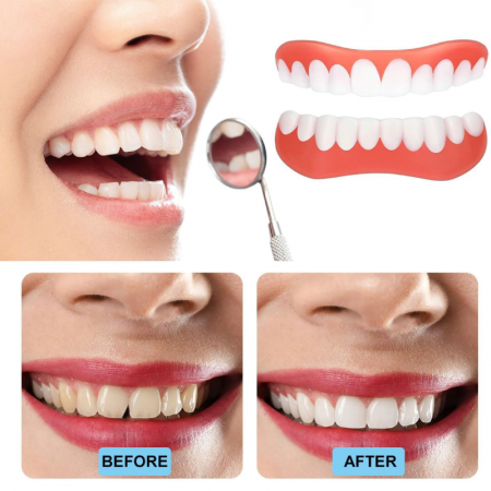 Set Proteze Dentare Premium SUPER TRENDS®, Contine Partea de Sus 1 Buc si Partea Jos 1 Buc, Fatete Dentare Cosmetice, Acopera Dintii Lipsa, Zambet Perfect, Silicon, Alb-Roz [3]