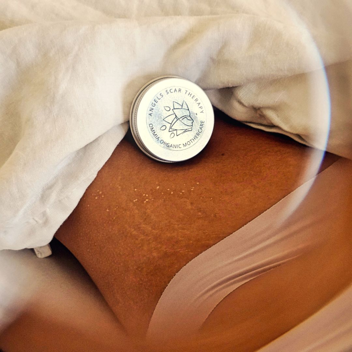 Balsam pentru cicatrici Angels Scar Therapy (30 ml) [3]