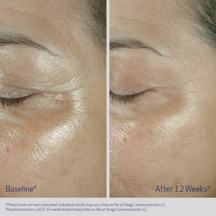 OBAGI ELASTIderm Eye Cream 15g [3]