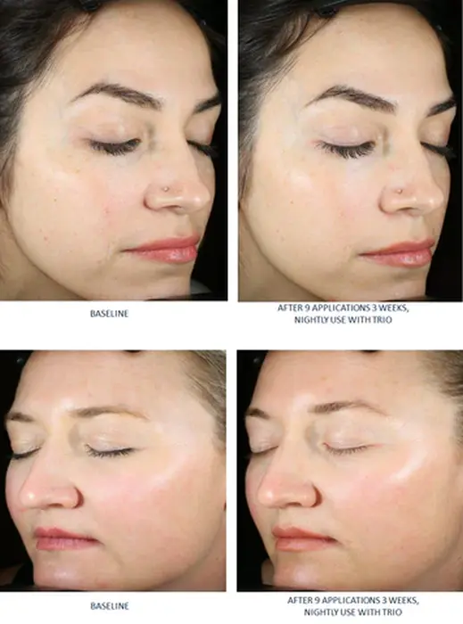SkinBetter AlphaRet Exfoliating Peel Pads 30 buc. [7]