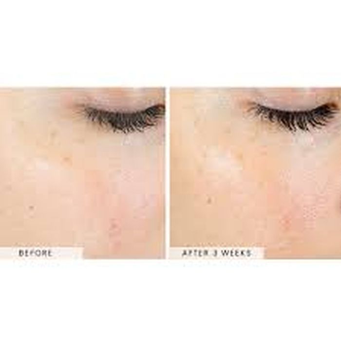 SkinBetter AlphaRet Exfoliating Peel Pads 30 buc. [5]