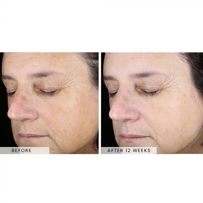 SkinBetter Even Tone Correcting Serum 50ml [2]