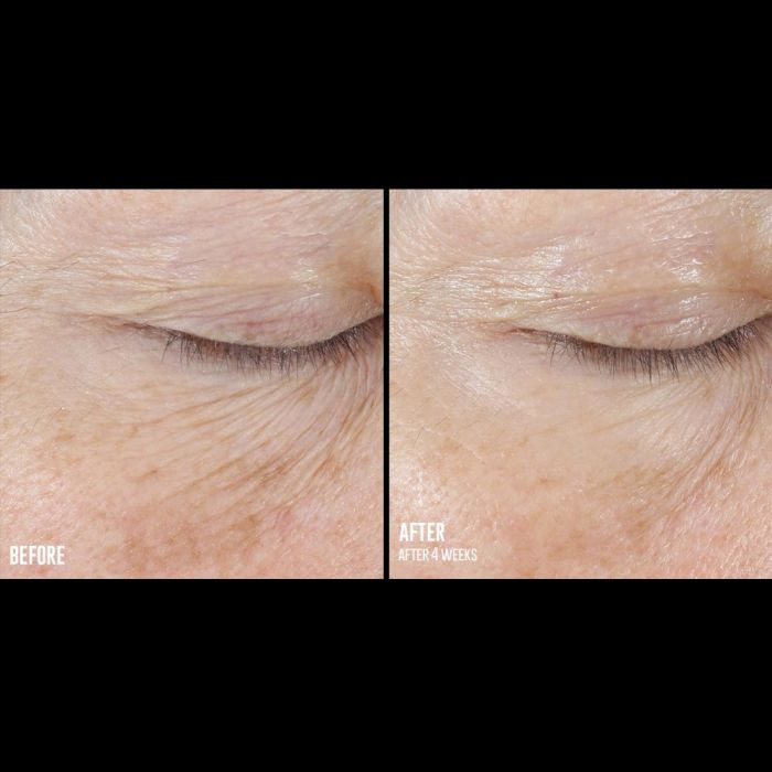 SkinBetter InterFuse Treatment Cream Eye 15ML [2]