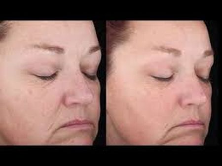 COLORESCIENCE Even Up™ Clinical Pigment Perfector SPF50 [3]