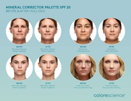 Colorescience Mineral Corrector Palette SPF20 12g [2]