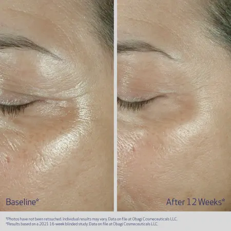 OBAGI ELASTIderm Eye Cream 15g [2]