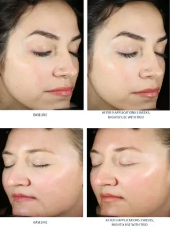 SkinBetter AlphaRet Exfoliating Peel Pads 30 buc. [6]