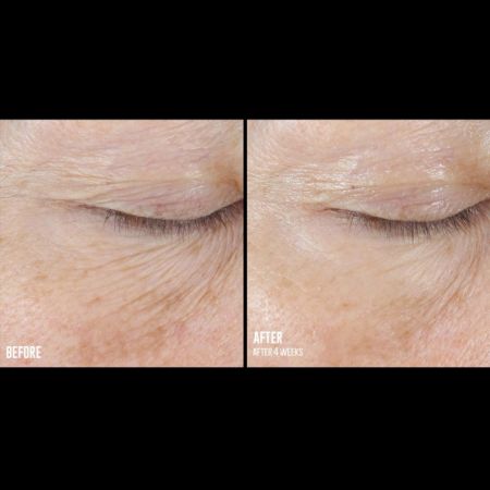 SkinBetter InterFuse Treatment Cream Eye 15ML [1]