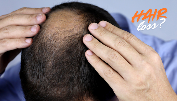 Căderea părului la bărbați: de ce apare și ce poți face concret