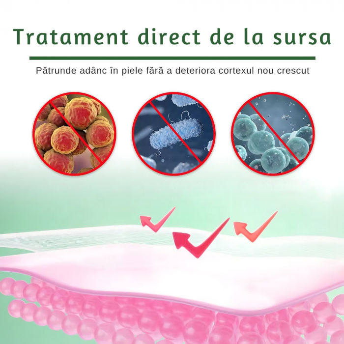 Set 5 perechi de masti exfoliante pentru picioare tip soseta, elimina pielea moarta si hidrateaza [2]