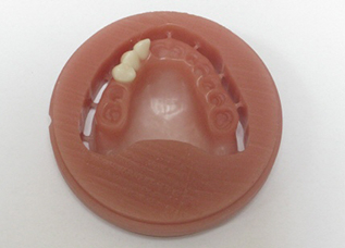 Dentalos Plus® (High-performance PMMA) [5]