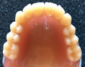 Eldy Plus ® (high-performance polymer of the PET group) [4]