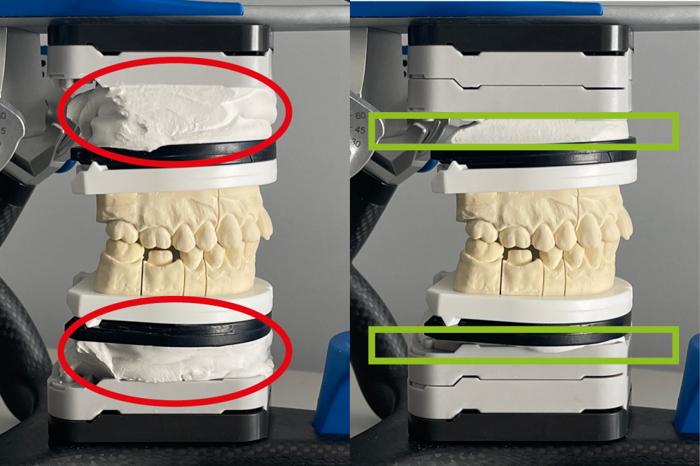 ROTOCLICK SPLITEX COUNTERPLATES [3]