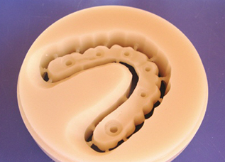 Dentalos Plus® (High-performance PMMA) [1]