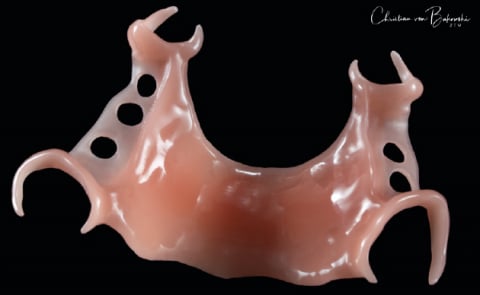 Eldy Plus ® (high-performance polymer of the PET group) [1]