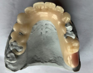 Eldy Plus ® (high-performance polymer of the PET group) [2]