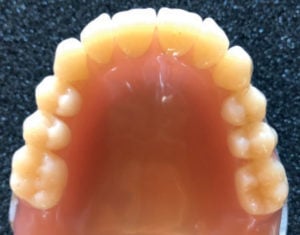 Eldy Plus ® (high-performance polymer of the PET group) [3]