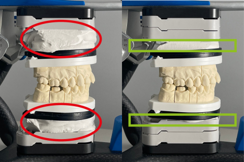 ROTOCLICK SPLITEX COUNTERPLATES [2]