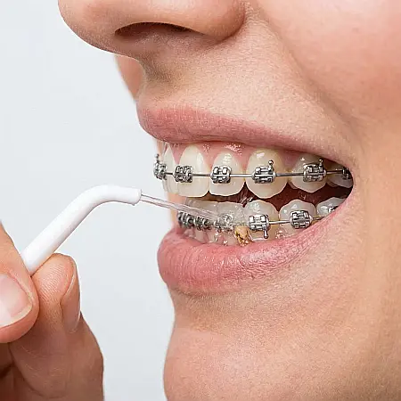 Irigator Bucal Manual pentru Igienă Orală – 40 ml, Jet de Apă Puternic, Curățare Interdentară, Alb, Fără Baterii sau Încărcare, Ideal pentru Aparat Dentar, Coroane și Punți [1]