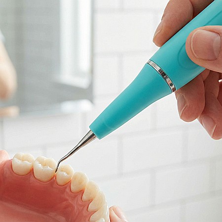 Electronice - Dispozitiv Ultrasonic Portabil pentru Dinți – Îndepărtare Tartru și Placă Bacteriană, Compact și Ergonomic