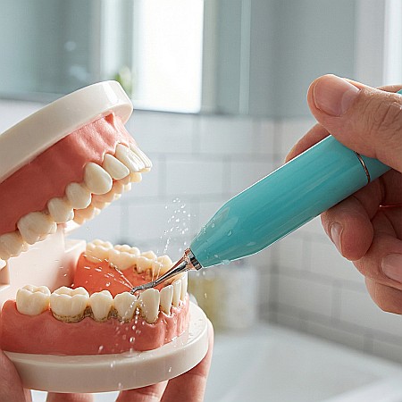 Dispozitiv Ultrasonic Portabil pentru Dinți – Îndepărtare Tartru și Placă Bacteriană, Compact și Ergonomic [1]