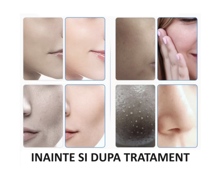 Aparat Profesional Cosmetic Rejuvenare Faciala 7 in 1 Multifunctional, Masca LED, Hidrogenare, Dermabraziune, Hydra Beauty, Anti-Imbatranire, Lifting, Indepartarea ridurilor [7]