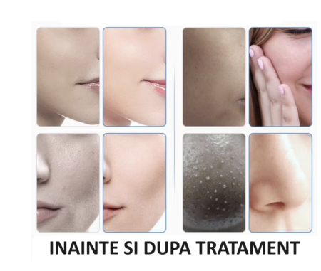 Aparat Profesional Cosmetic Rejuvenare Faciala 7 in 1 Multifunctional, Masca LED, Hidrogenare, Dermabraziune, Hydra Beauty, Anti-Imbatranire, Lifting, Indepartarea ridurilor [6]