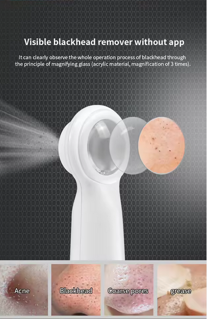 Eliminator puncte negre electric pentru Porii Faciali & Kit Strip nas [4]