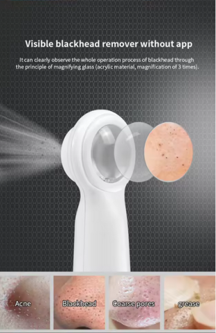 Eliminator puncte negre electric pentru Porii Faciali & Kit Strip nas [3]